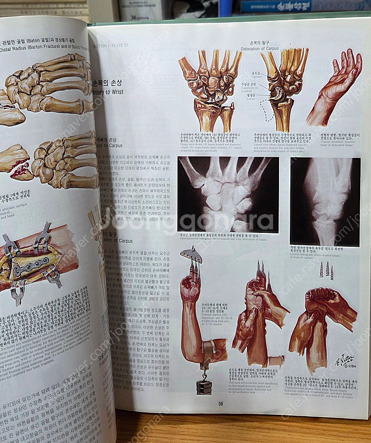 CIBA 원색도해의학총서 전13권 특A급 택포--5