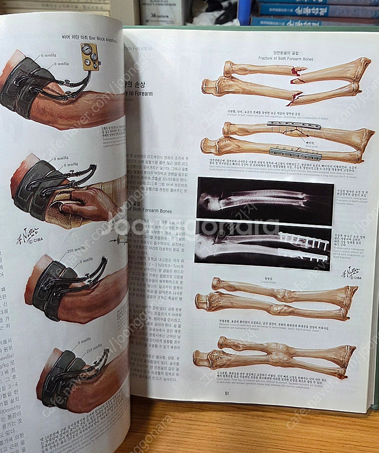 CIBA 원색도해의학총서 전13권 특A급 택포--6