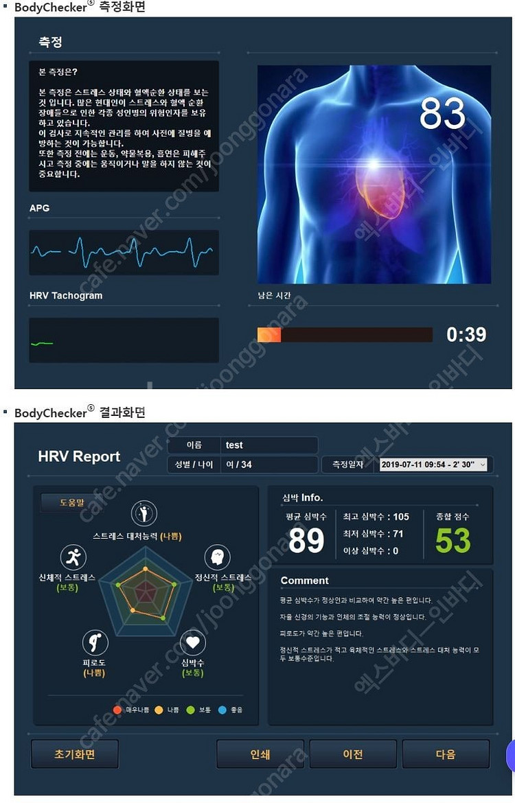 메디코어 스트레스 진단기 판매(임대) 가능합니다.--4