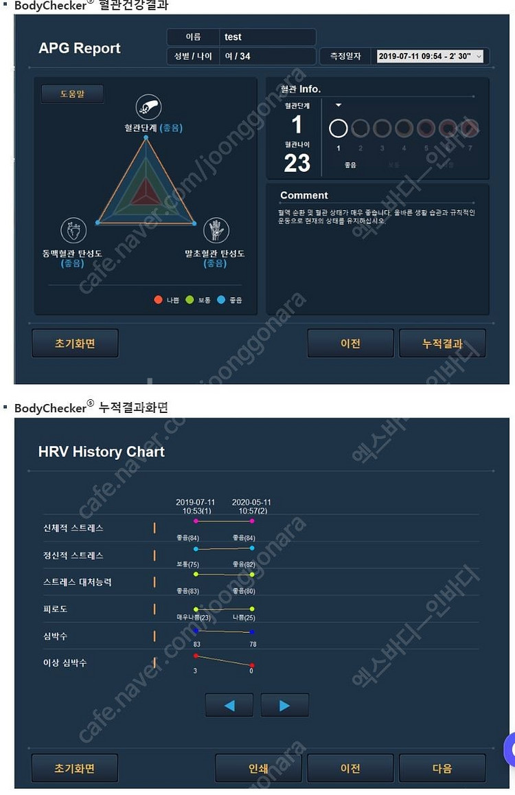 메디코어 스트레스 진단기 판매(임대) 가능합니다.--5
