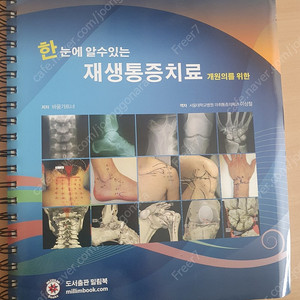 재생통증치료 프롤로 prolotherapy