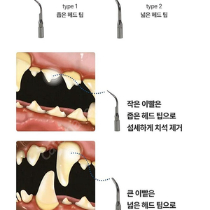 반려견 치석제거기