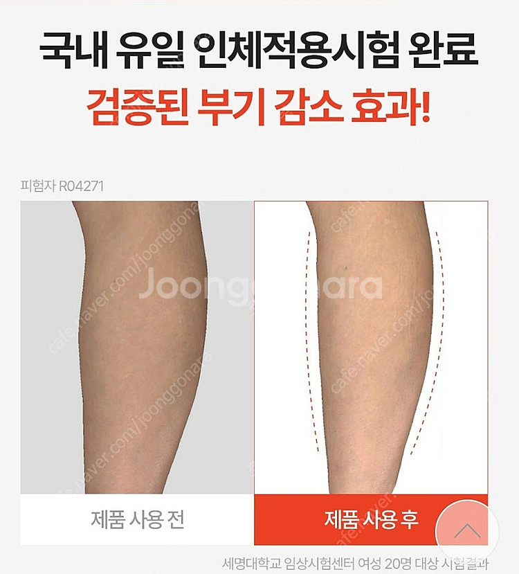 스파알 종아리 마사지기 택포.--1