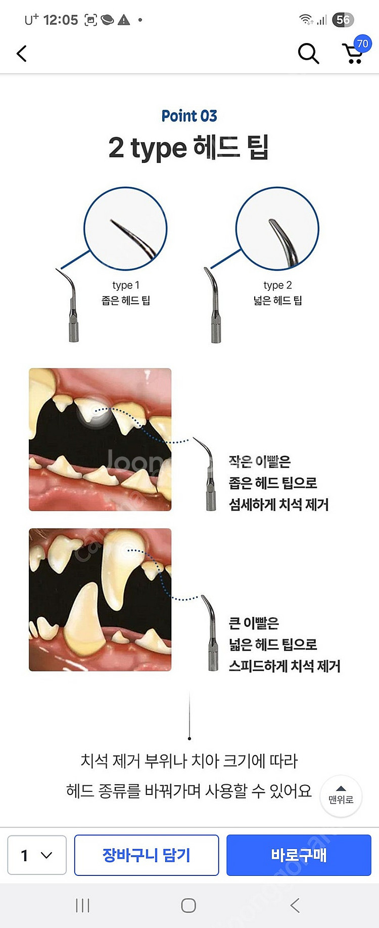 반려견 치석제거기--0