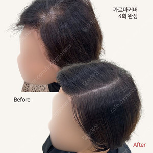 정수리, 가르마 탈모로 고민하신다면 이 상품!!