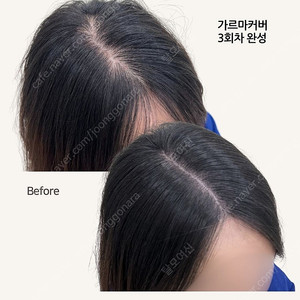 정수리, 가르마 탈모로 고민하신다면 이 상품!!