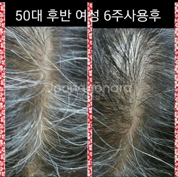 500ml씨놀 X10 샴푸 탈모 흰머리염색 대머리 비듬--5