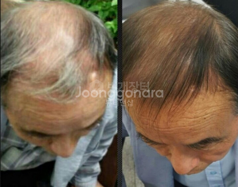 500ml씨놀 X10 샴푸 탈모 흰머리염색 대머리 비듬--6