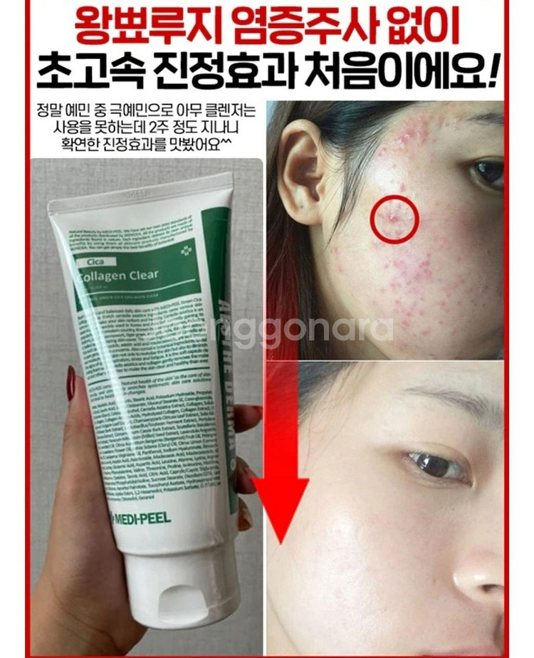 딥클롄징 블랙헤드 피지제거 모공수축 클렌징오일 화장품--0
