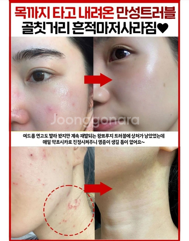 딥클롄징 블랙헤드 피지제거 모공수축 클렌징오일 화장품--3
