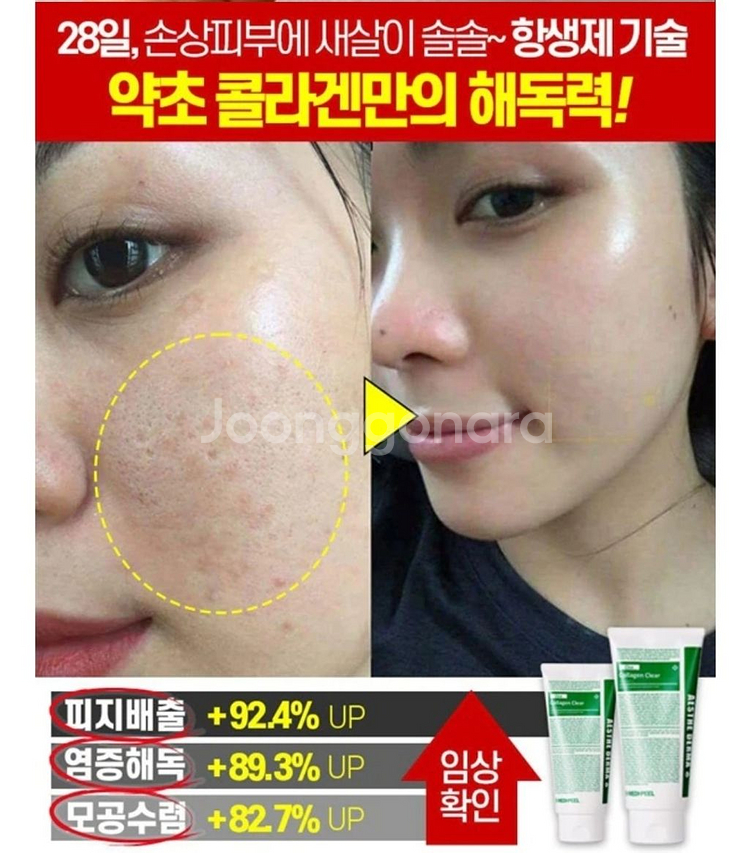 딥클롄징 블랙헤드 피지제거 모공수축 클렌징오일 화장품--7