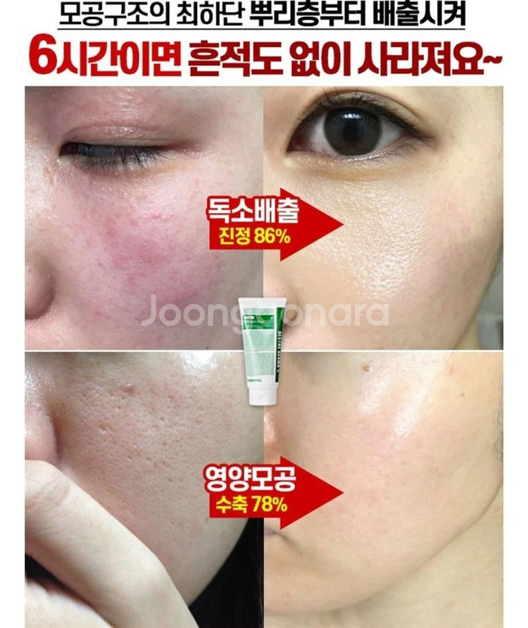 딥클롄징 블랙헤드 피지제거 모공수축 클렌징오일 화장품--6