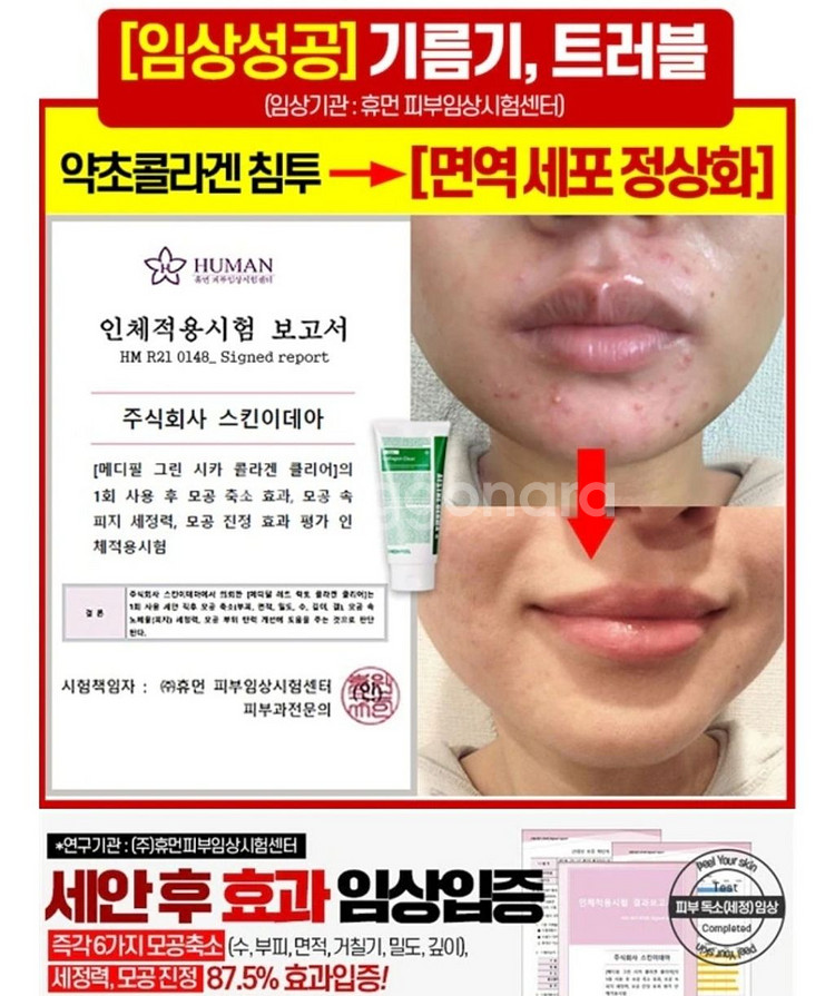 딥클롄징 블랙헤드 피지제거 모공수축 클렌징오일 화장품--9