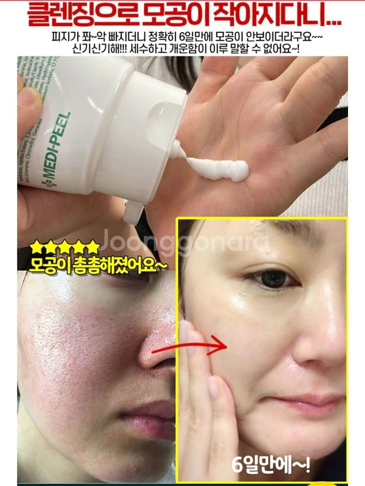 딥클롄징 블랙헤드 피지제거 모공수축 클렌징오일 화장품--4