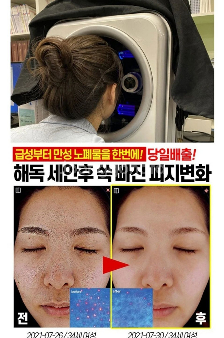 딥클롄징 블랙헤드 피지제거 모공수축 클렌징오일 화장품--8