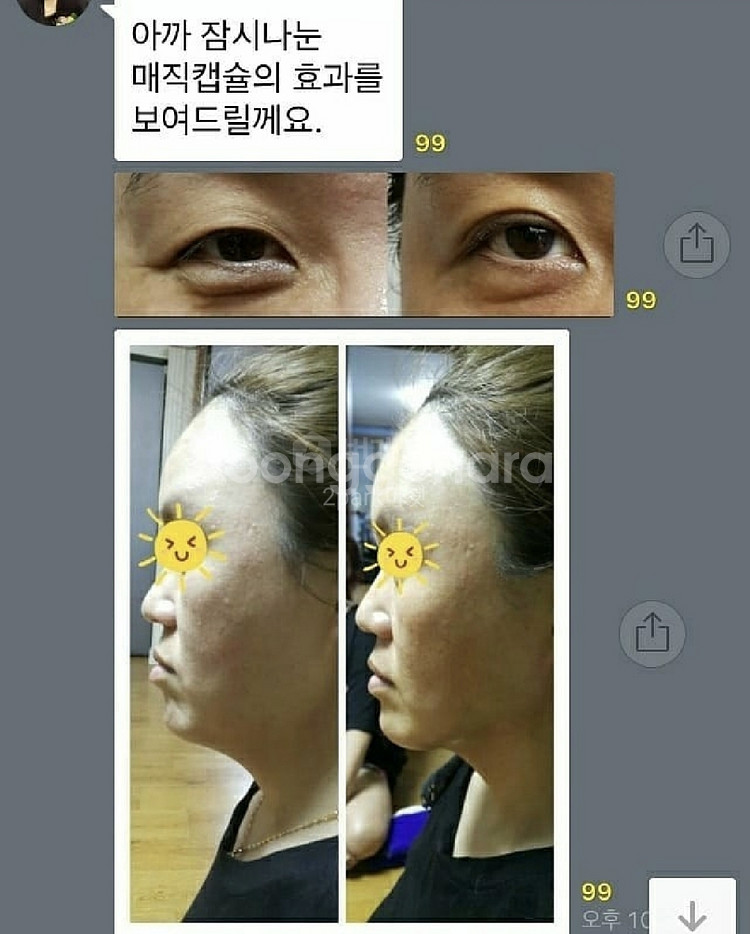 케어셀라 매직 캡슐(택비무료)새제품--5