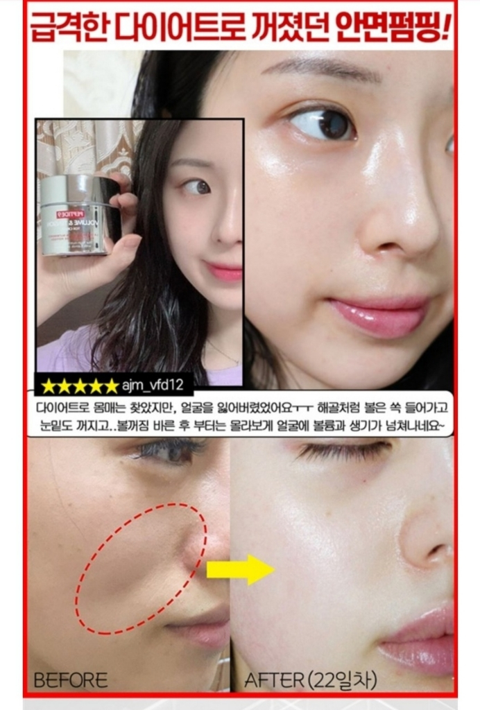 볼꺼짐 리프팅 필러 탄력 물광 보르피린 보톡스 주름개선 이미지