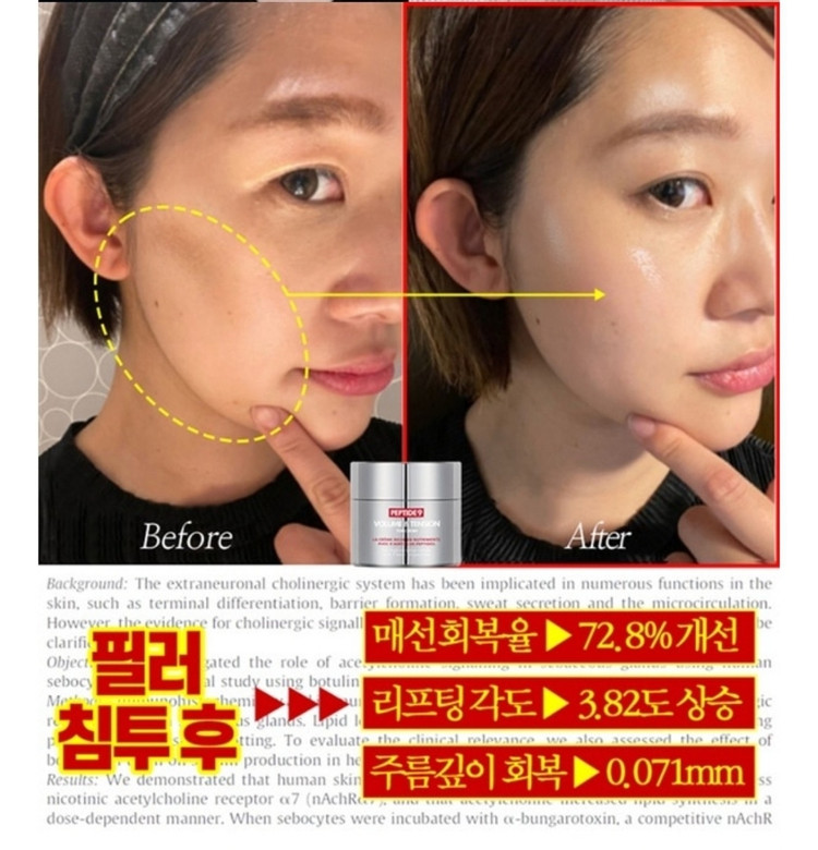 볼꺼짐 리프팅 필러 탄력 물광 보르피린 보톡스 주름개선 이미지