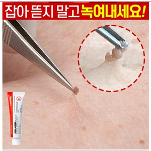 비립종 쥐젖 만능스팟 제거 편평사마귀 한관종 저자극