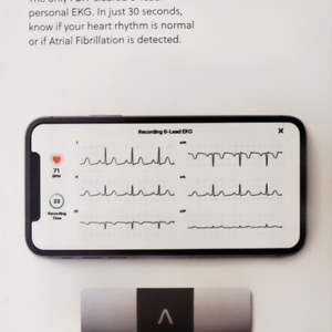 AliveCor KardiaMobile 6L