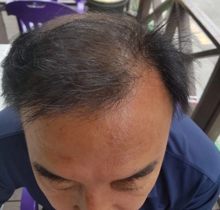 탈모샴푸.R2x헤어킵에너자이징샴푸 이미지