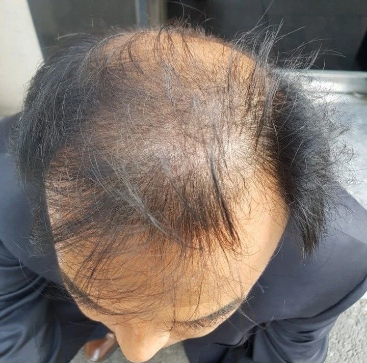 탈모샴푸.R2x헤어킵에너자이징샴푸 이미지