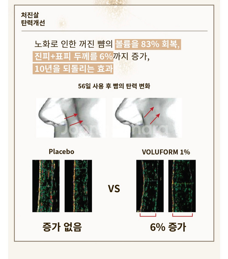 양태반 리프팅 앰플팩--3