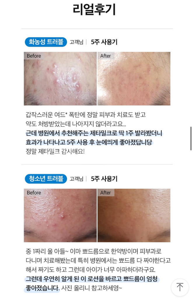 제티밀크 에센스 50ml (여드름, 모공완화 / 특허)--0