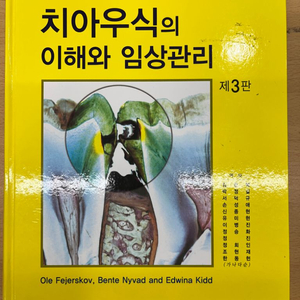 치아우식의 이해와 임상관리 제3판 대한나래출판사(치대)