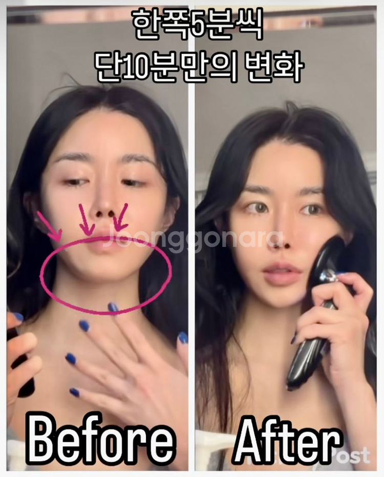 볼렉시 EMS 페이스/바디 겸용 미용기기--2