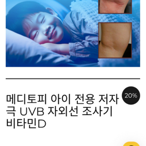 메디토피 uvb 조사기