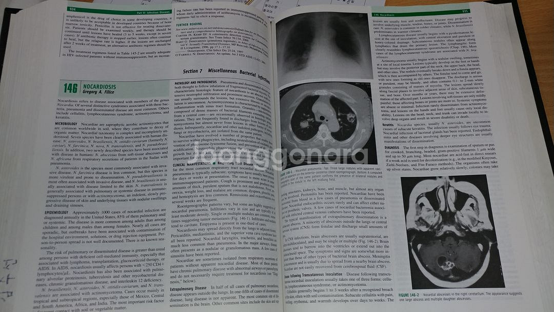 내과 원서 팔아요 Internal Medicin--4