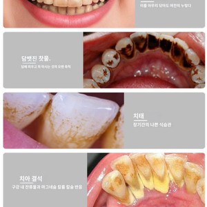 새-초음파 전동치석세척기 치석제거기x2미백전동칫솔x3