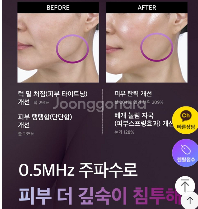 듀얼소닉알토고주파관리기기--3