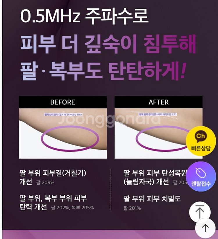 듀얼소닉알토고주파관리기기--4