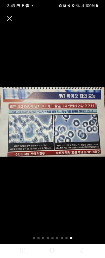 수지기 팔찌--5