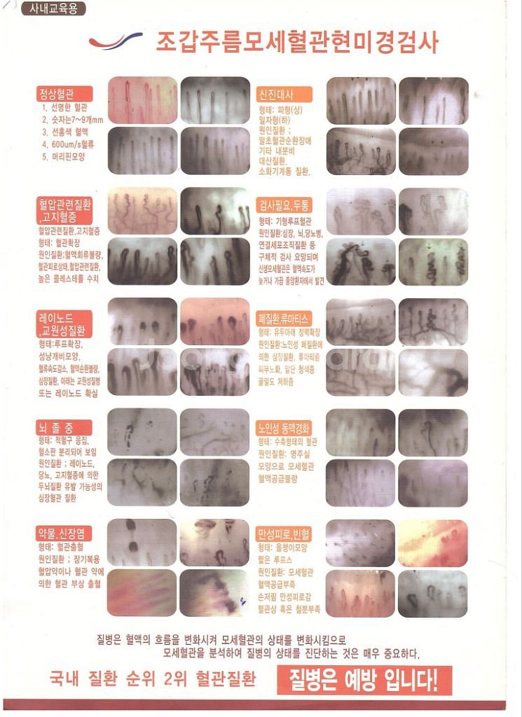 혈류개선을 도와 혈액순환을 왕성하게 해주는 토르마린--7