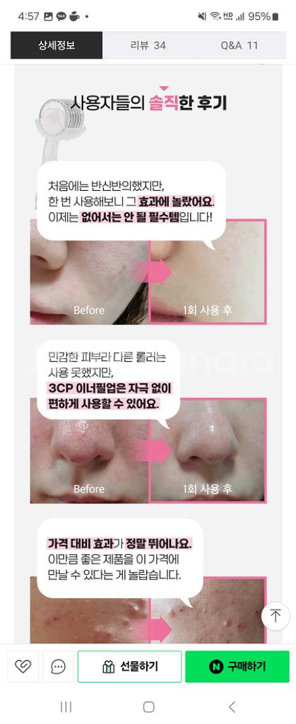 [3CP 이너필업] mts롤러 1개+에어리스 펌프 앰플--5