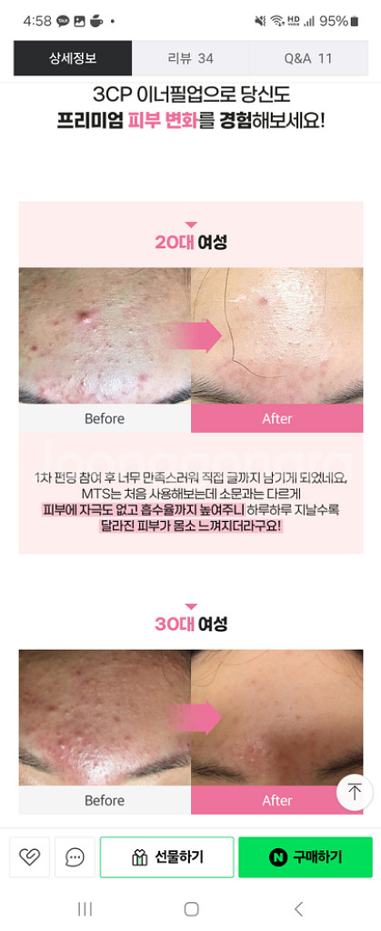 [3CP 이너필업] mts롤러 1개+에어리스 펌프 앰플--4