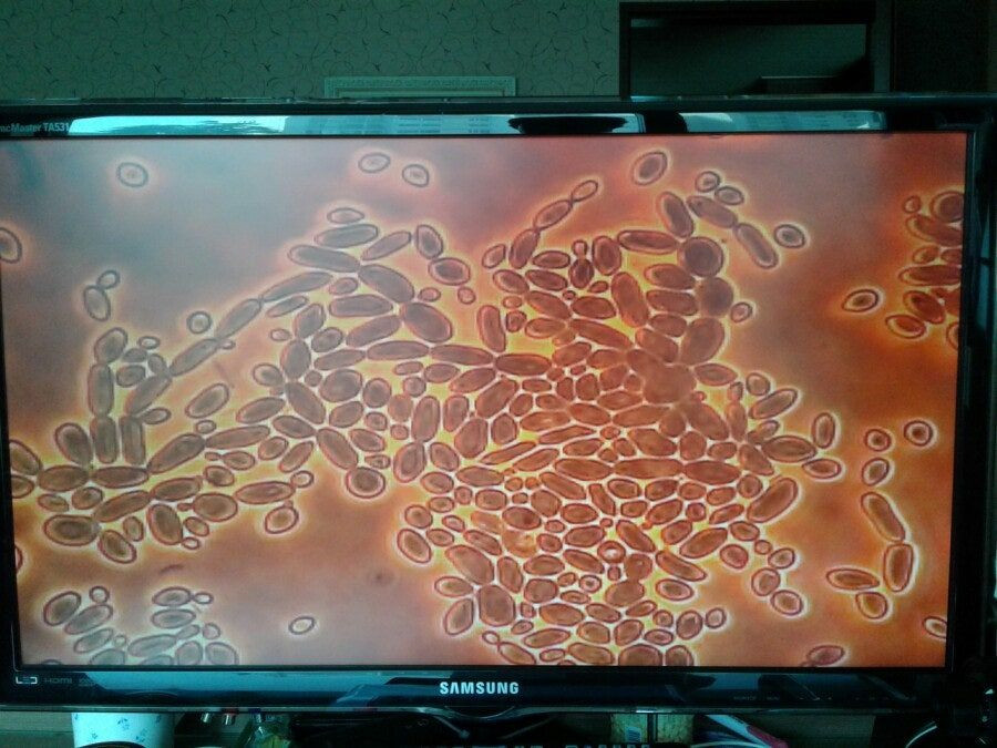 칼자이즈위상차현미경 대여렌탈 이미지