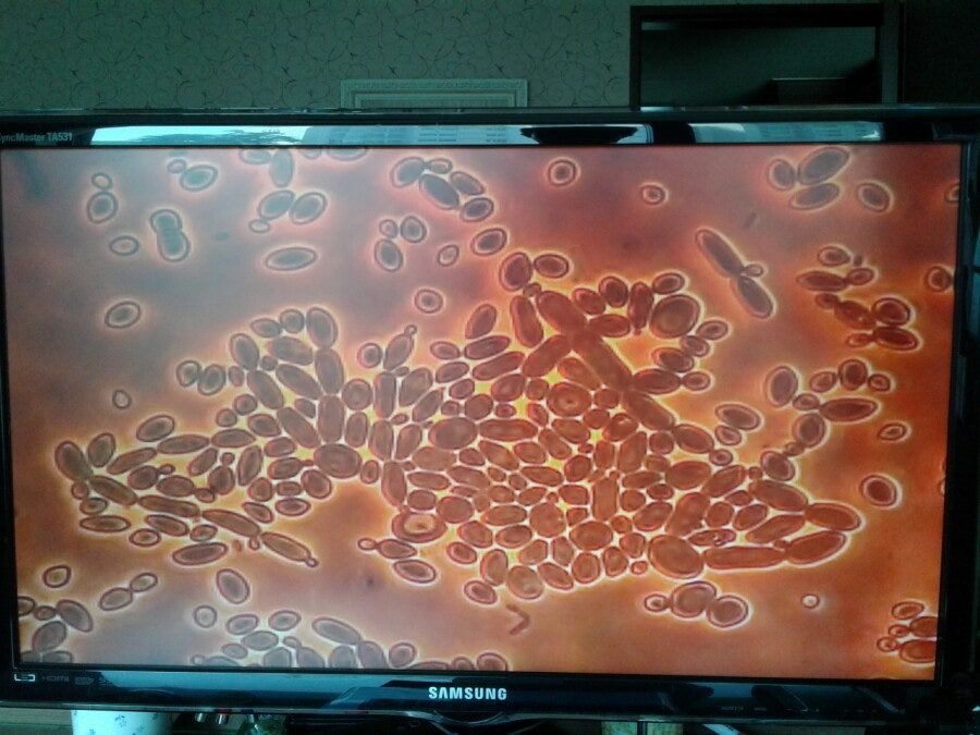 칼자이즈위상차현미경 대여렌탈 이미지