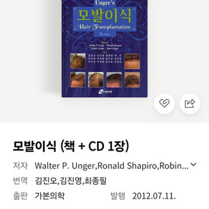 walter. p. unger의 모발이식 책. 가본의학