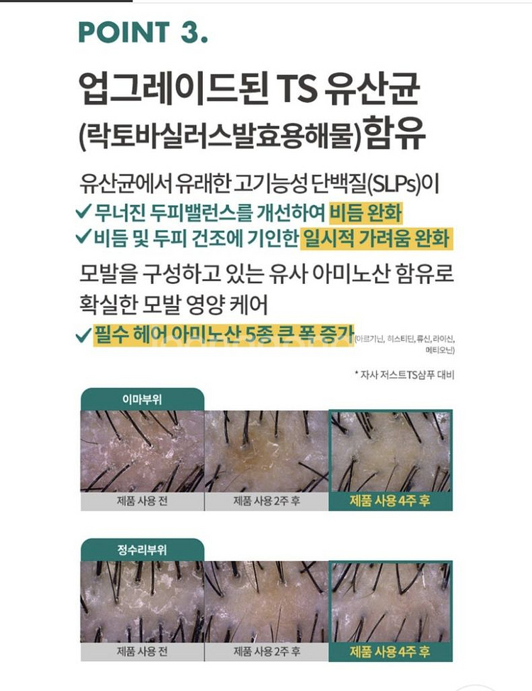 ts 엑스비오틴 탈모방지샴푸 24년 최신상--8