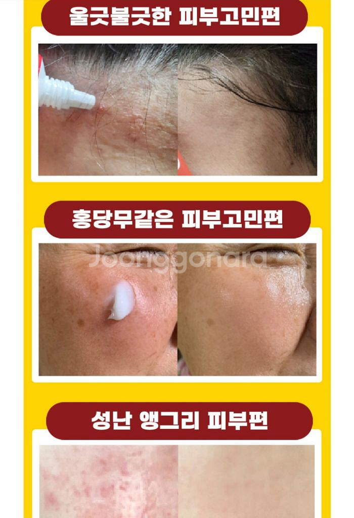 기미잡티제거크림 2개 트러블크림 안면홍조 미백특허성분--4