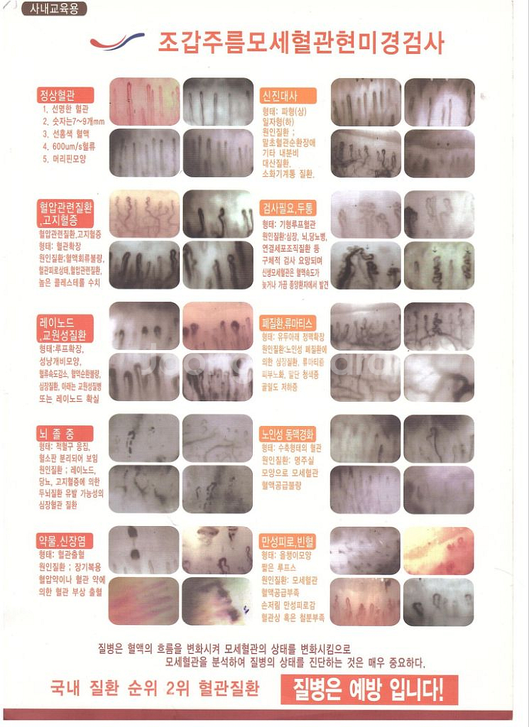 혈액순환을 왕성하게 해주는 기적의광석 토르마린 1+1--7