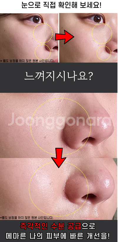 애슈미 블랙스네일 퍼펙트 하이드레이터 5종 세트 새제품--4