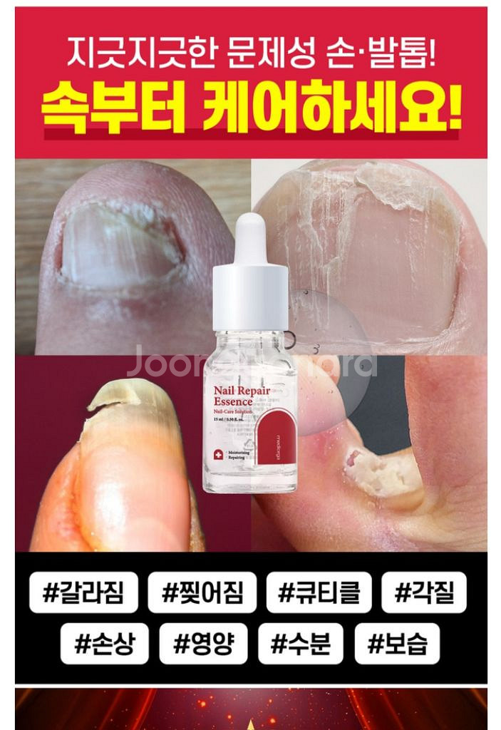 새상품) 네일 리페어 에센스 판매--5