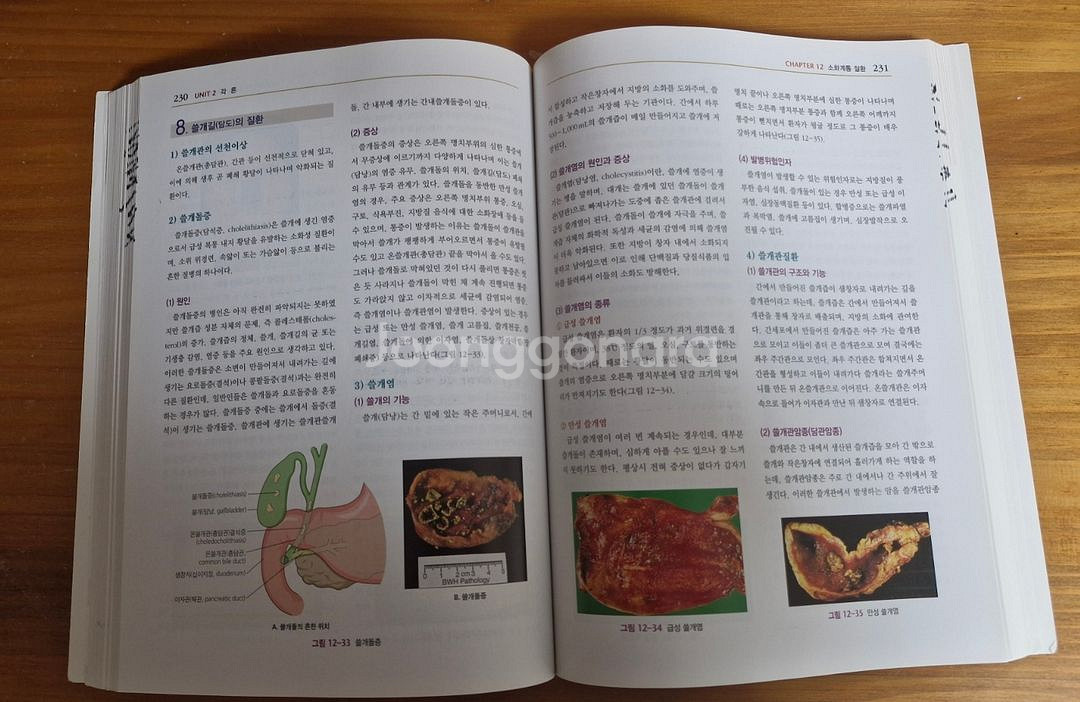 현문사 병리학 교과서 5판 전공서적--1