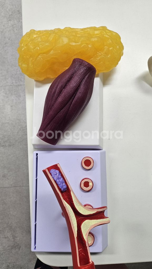 지방 근육 혈관 모형--0