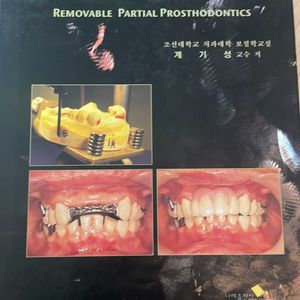 가철성 국소의치학 제 4판